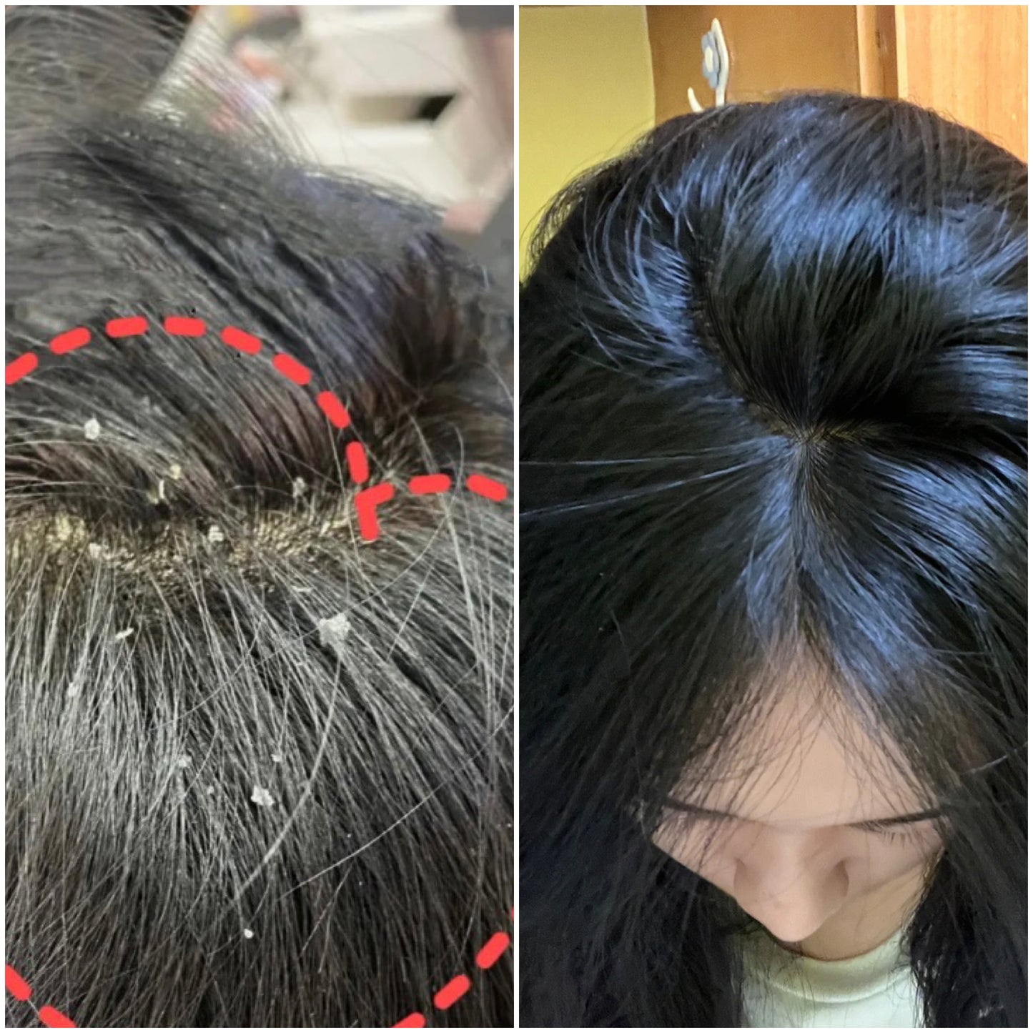 Exfoliating Glove & Scalp Massager Scrubber Set